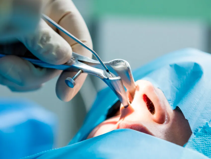 Avaliação para Cirurgias Funcionais Nasais