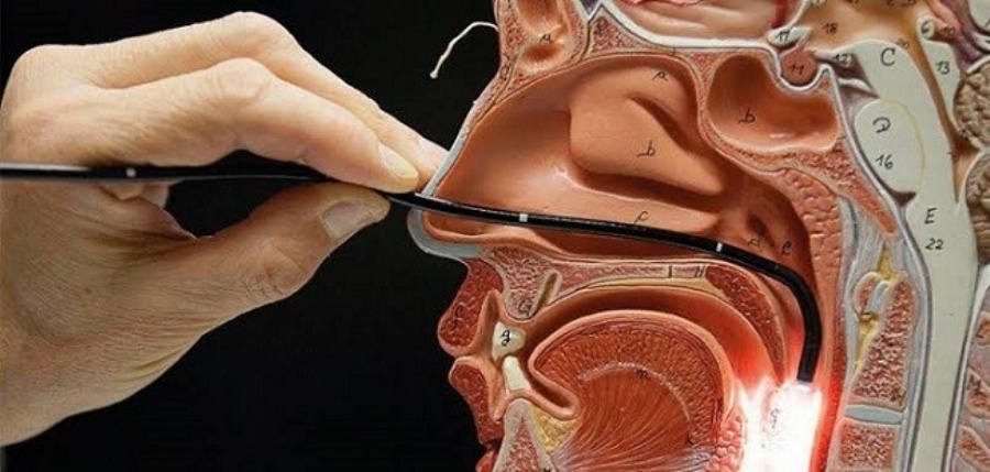 Nasofibrolaringoscopia